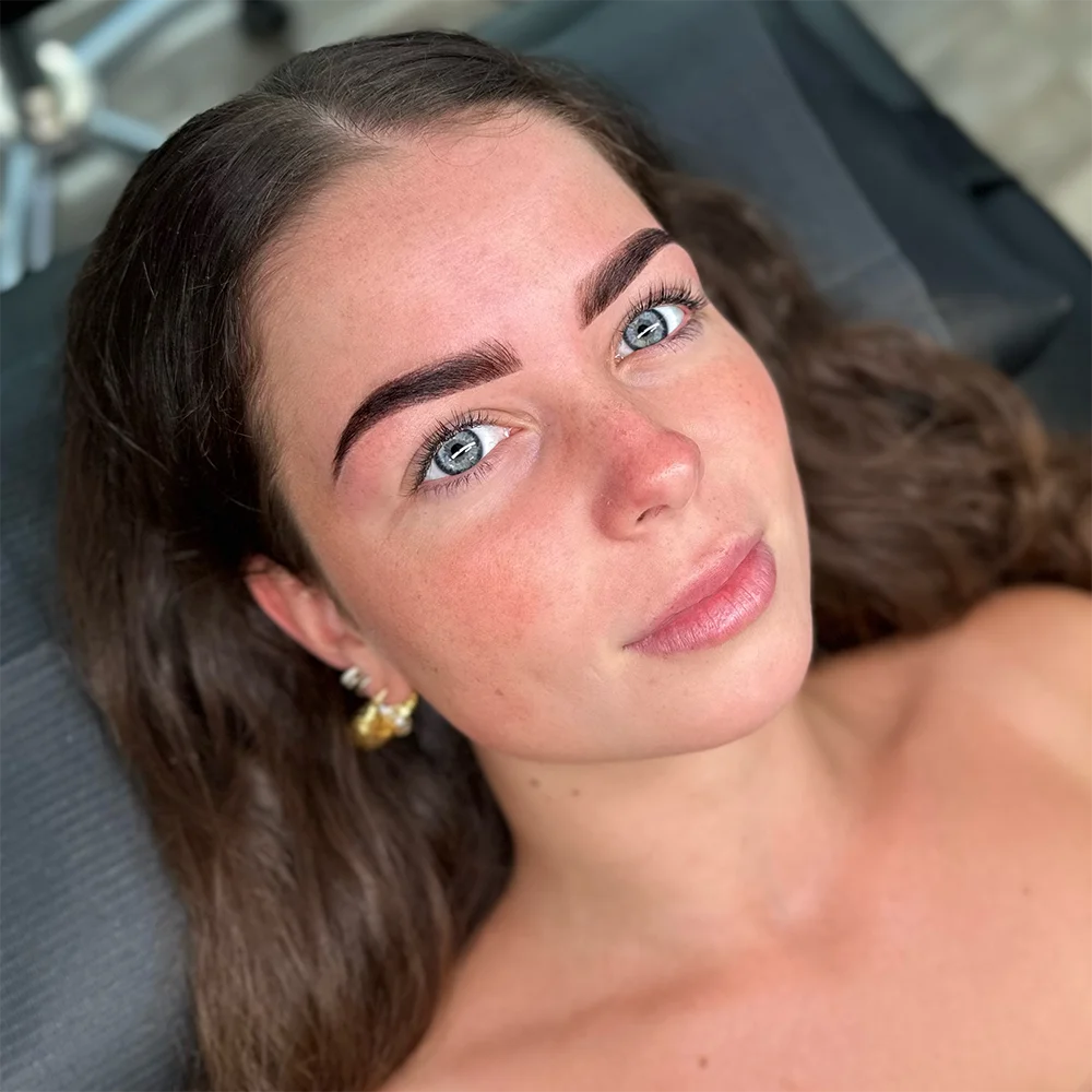Brow mapping resultaat